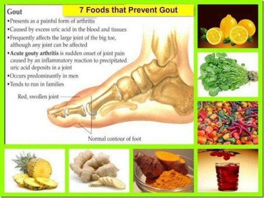 gout